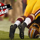 Image for article titled Why Your Team Sucks 2014: Washington Redskins